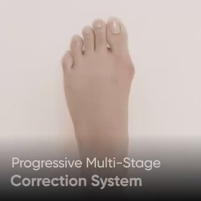 AlignaPro™ Corrector Ortopédico [Realinea tus Dedos sin Dolor]